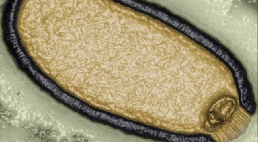 Zombi virüs uyarısı! Ölümcül yeni salgın yolda