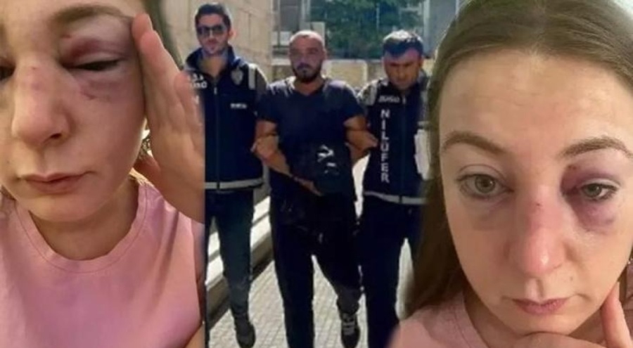 Bursa'da 9 kafa darbesiyle yaraladığı eski sevgilisine farklı şekilde de şiddet uygulamış!