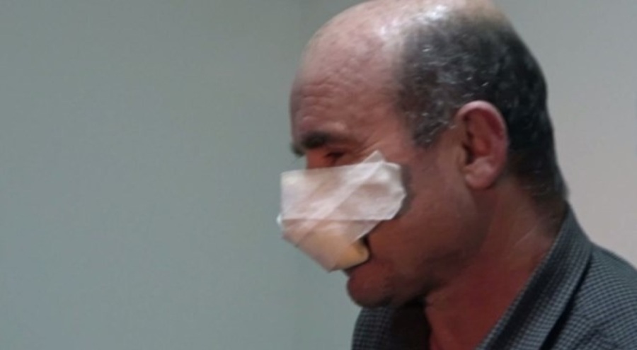 Başıboş köpek saldırdı!