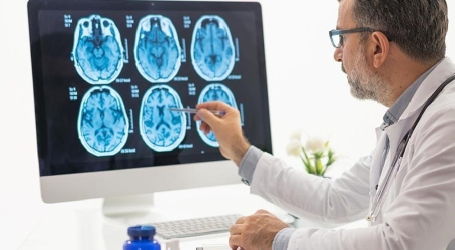 Uzmanından, beyin kanamasında 'erken teşhis' uyarısı geldi!