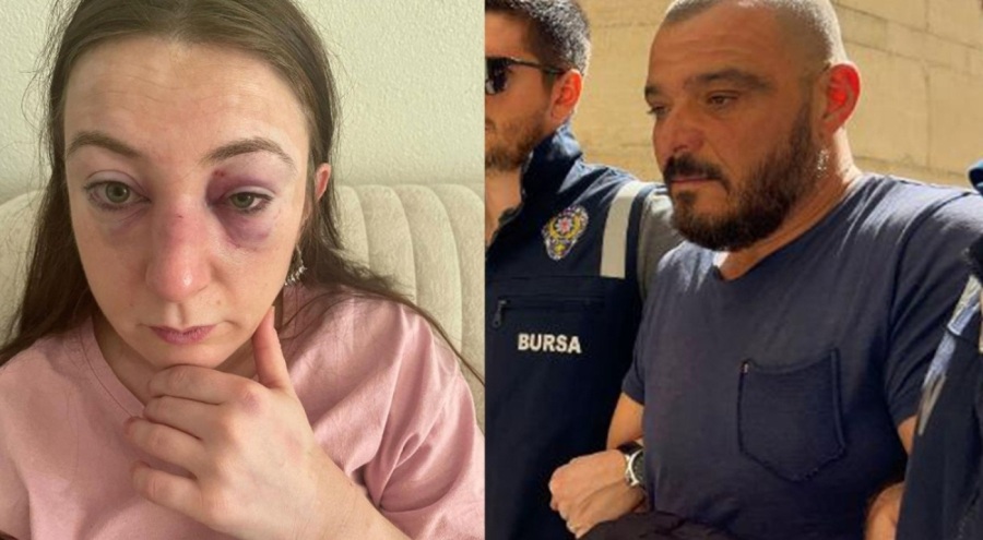 Bursa'da eski kız arkadaşını kafa darbeleriyle yaralamıştı... Cezası belli oldu!