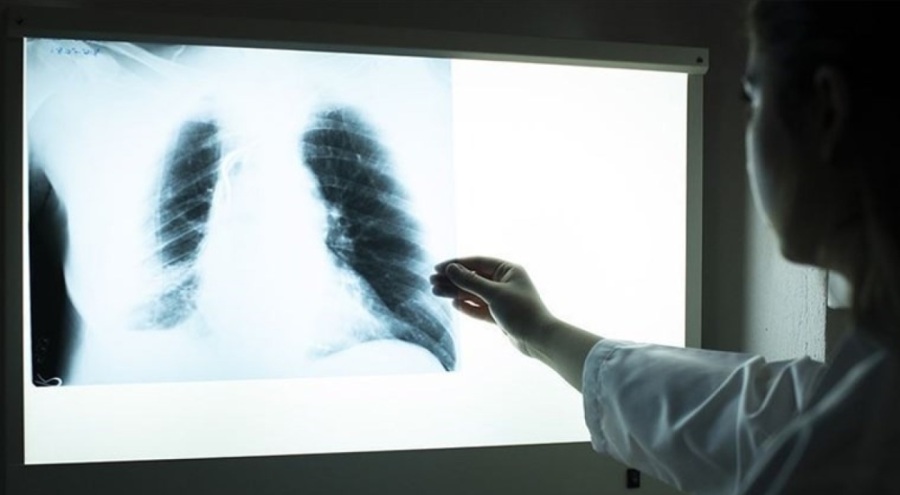 Uzmanı açıkladı: KOAH yalnızca sigara içenlerde görülmüyor!