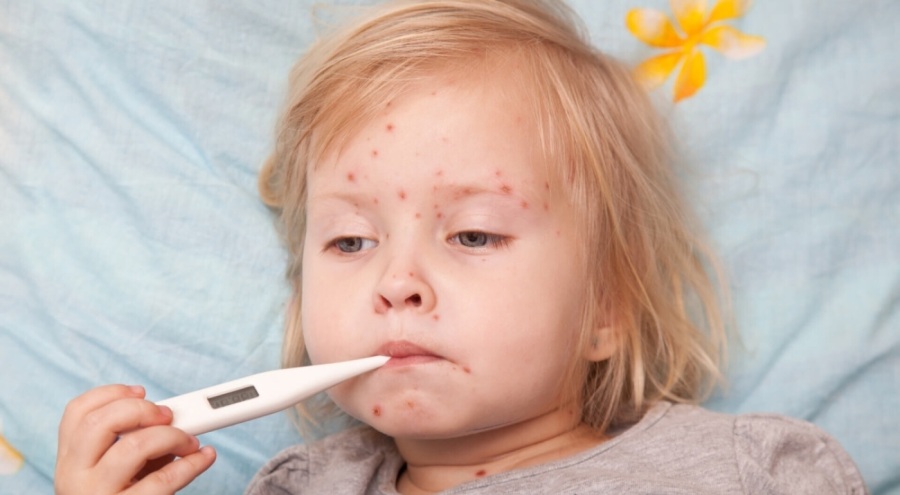 DSÖ uyardı: Kızamık vakaları arttı