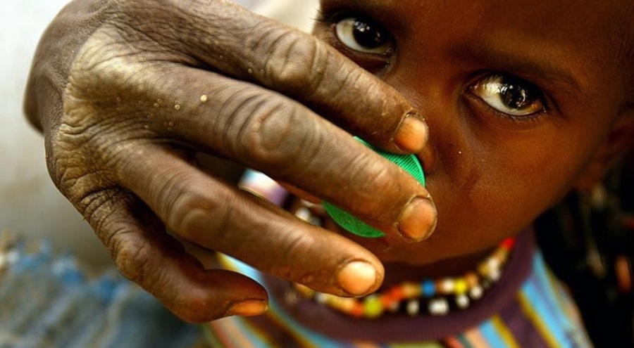 BM acı tabloyu duyurdu: Savaş nedeniyle en az 25 milyon insan açlıkla boğuşuyor