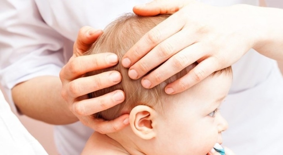 Uzmanı duyurdu: Bebeklerde görülen kafa şekil bozuklukları neden olur?