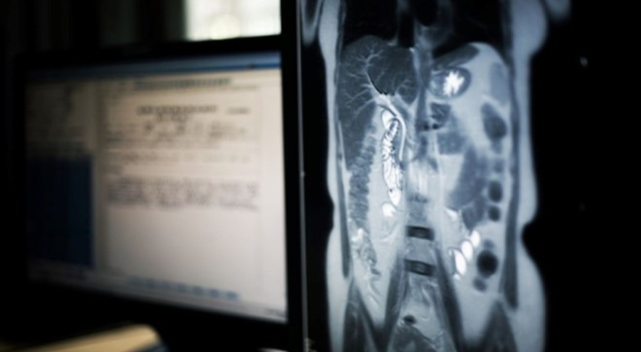 Kanada'da yerli halk "gizli deney" iddiasıyla doktorlara dava açtı