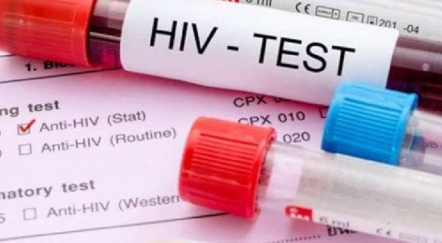 İlgezdi: "HIV vakaları dünyada azalırken Türkiye'de artıyor"