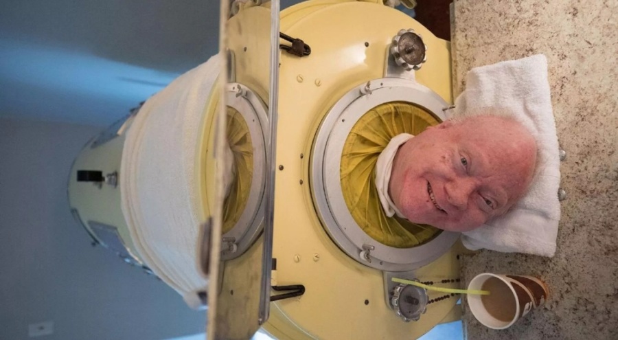 'Demir akciğerli adam' Paul Alexander hayatını kaybetti