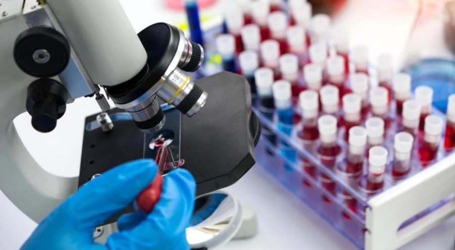 HIV tedavisinde umut veren gelişme: Gen düzenlemesi