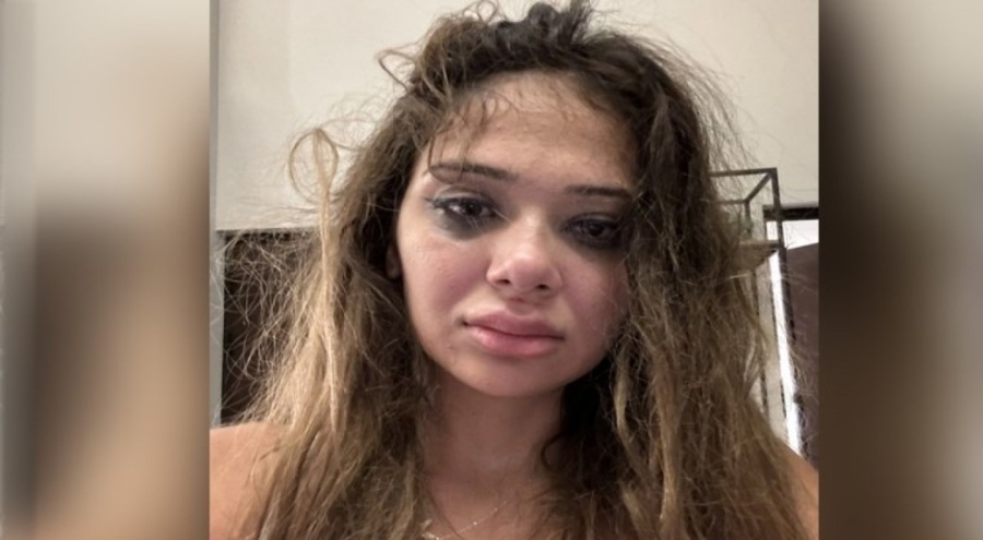 Merve Taşkın'a sevgilisinden şiddet: 'Karnıma, cinsel organıma tekme atıyordu'