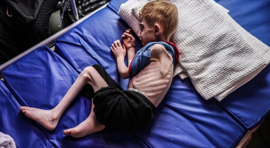 DSÖ: Gazze'de tahliye edilmesi gereken 8 bin hasta var