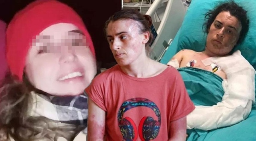 Eltisini bıçaklayıp kaynar suyla yakmıştı: 'Akıl hastası' çıktı