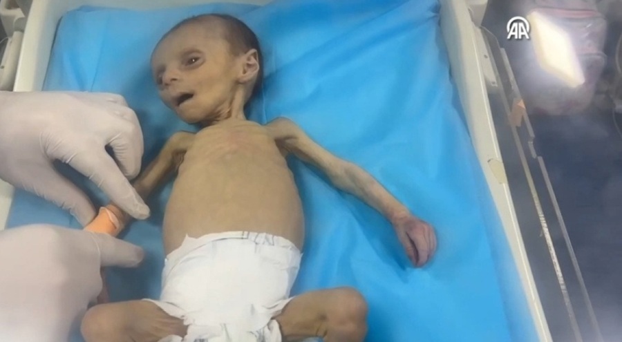 Gazze'de bebek ölümleri artıyor