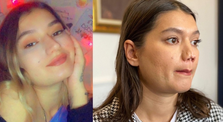 Düğünü iptal ettiren burun estetiği! Genç kız doktordan 1 milyon lira istiyor