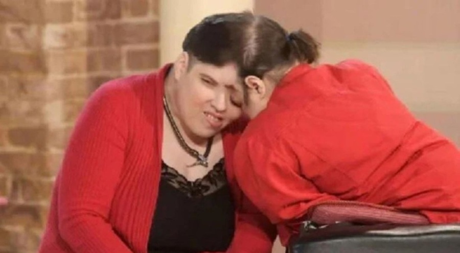 Dünyanın en yaşlı yapışık ikizleri 62 yaşında hayata veda etti