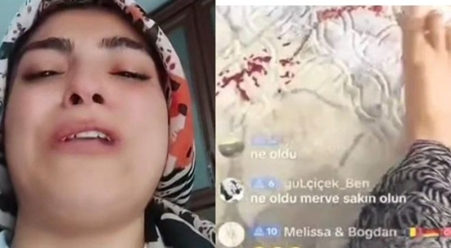 Çocuğu yaralıyken dakikalarca canlı yayın yapmıştı! Soruşturma başlatıldı