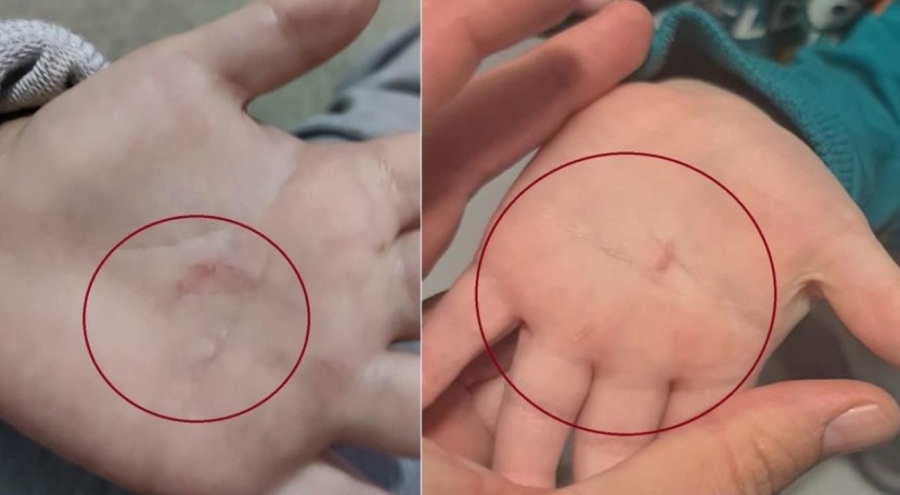 Bandırma Belediyesi'nin kreşinde şiddet iddiası