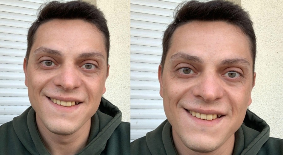 3. kattaki balkondan düşen genç adam kurtarılamadı