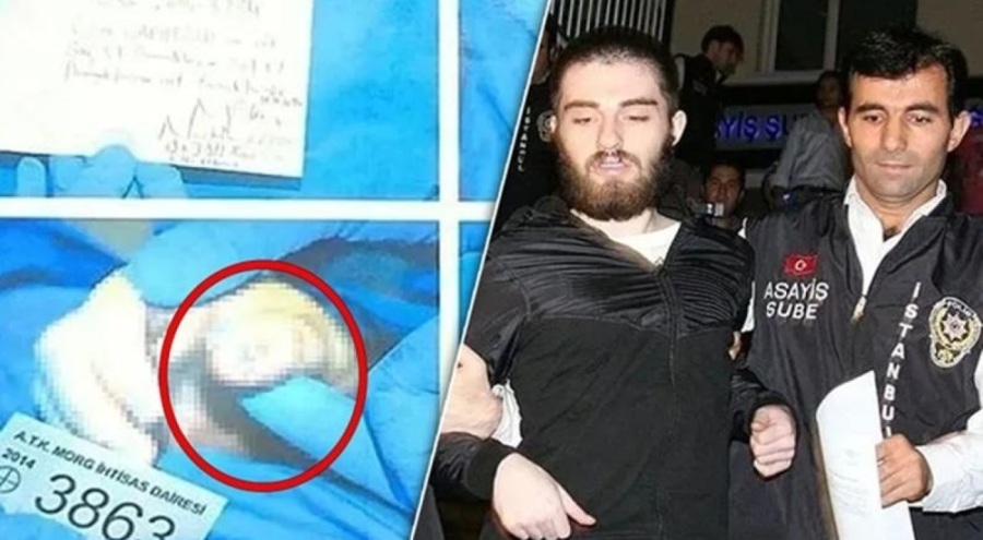 Cem Garipoğlu'nun elindeki mor lekelerin sırrı ortaya çıktı