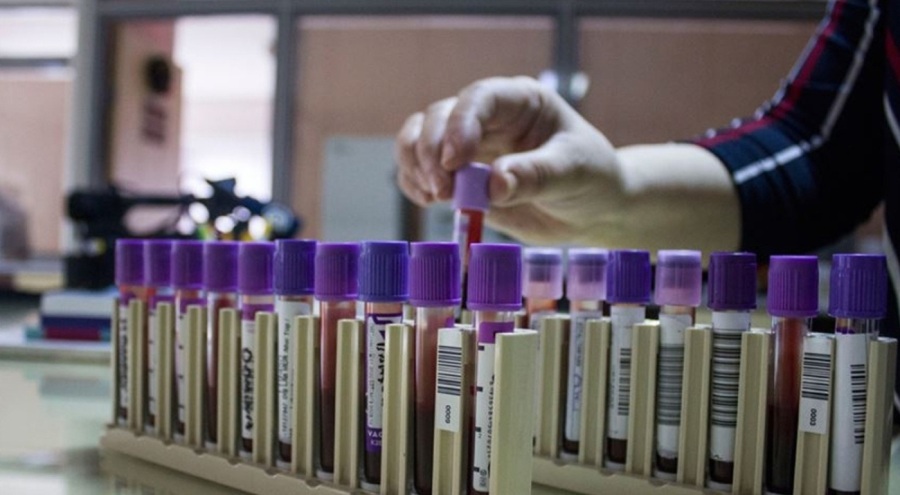 Talasemi ve demir eksikliği anemisi karıştırılmamalı