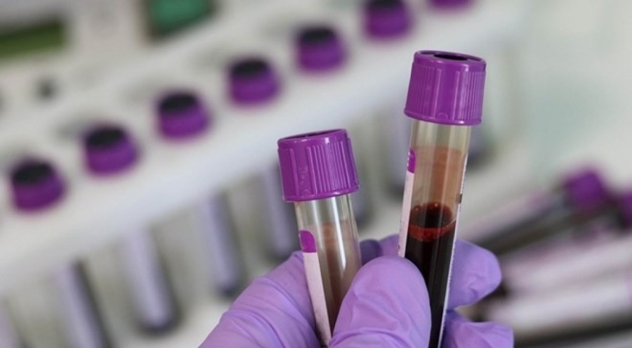 İngiltere'de hastanelere siber saldırı: Acil kan bağışı çağrısı