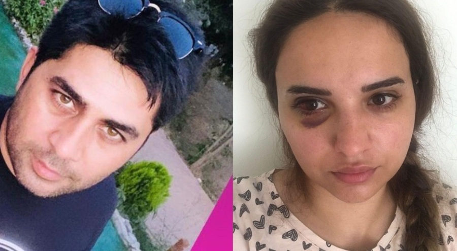 Boşanmak isteyen karısını darp edip bıçakladı, serbest bırakıldı!