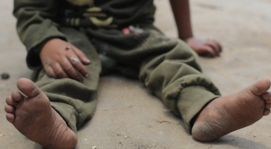 Hamas: Gazze'de 40'tan fazla çocuk açlıktan öldü