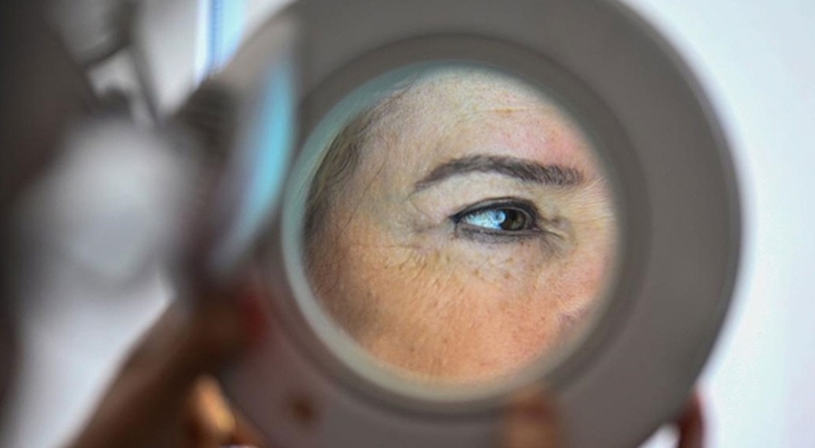 Sağlık Bakanlığından "cilt kanseri" uyarısı