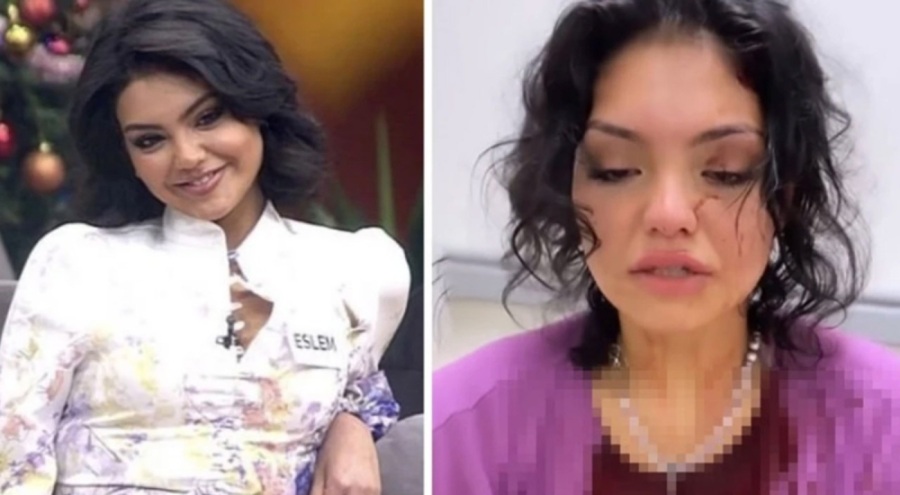 Genç fenomeni öldüresiye dövdüler! 'Beni yere yatırıp mahvettiler'