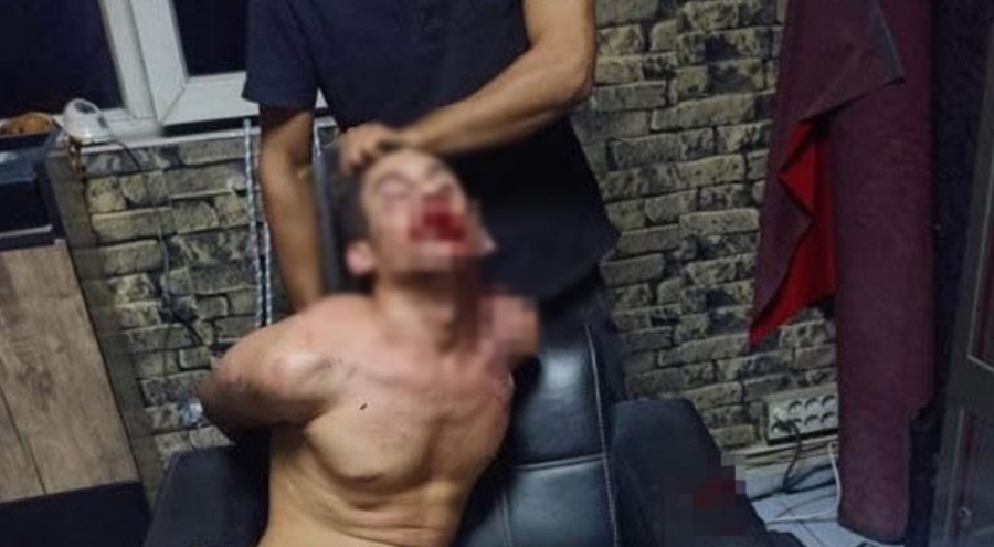 Maaşını ödemeyen patronun parasını alan gence işkence! Kerpetenle dişlerini söküp hamamböceği yedirdiler