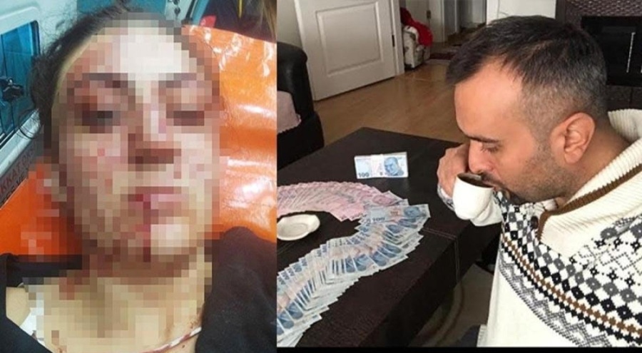 7 yerinden bıçaklandı, ölümden döndü! 9 ay sonra şoke eden karar