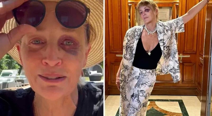 Bodrum'da tatil yapan dünyaca ünlü oyuncu Sharon Stone kaza geçirdi!