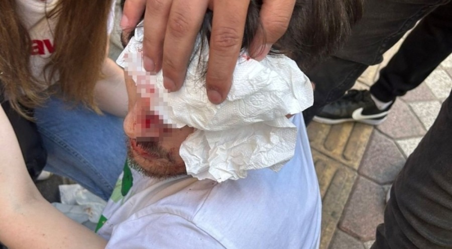 Tartıştığı motosikletlinin üzerinden aracıyla geçti