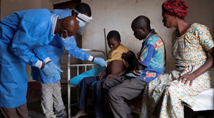 Yeni salgın maymun çiçeği: Aşısı yok!