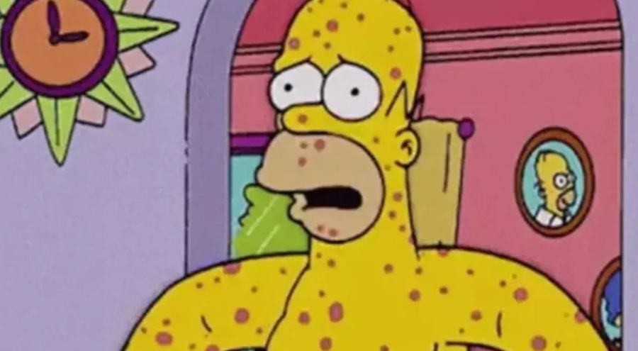 Maymun Çiçeği virüsünde Simpsonlar detayı!