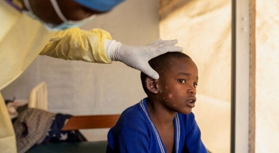 DSÖ'den maymun çiçeği çağrısı