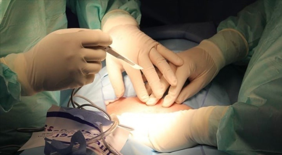 Bursa'da organ nakli ticareti sanıklarına 14'er yıla kadar hapis istemi