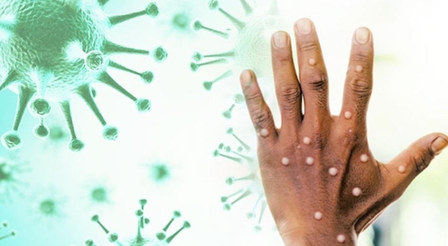 DSÖ'den endişe verici açıklama