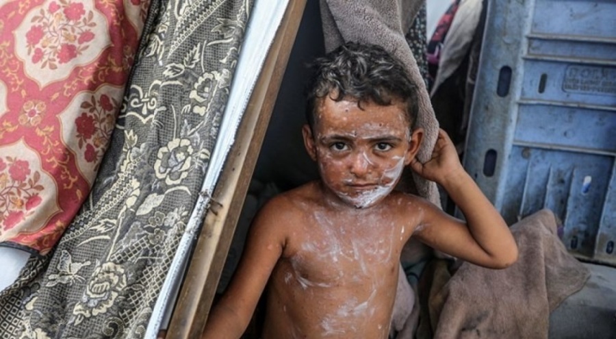 İsrail'in Gazze saldırırıları devam ediyor: Can kaybı 40 bin 405'e çıktı