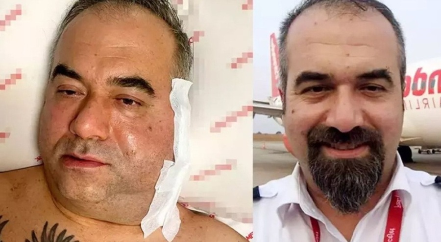 Pilotun ameliyatta ölümünde, 'doktor ihmali' iddiası