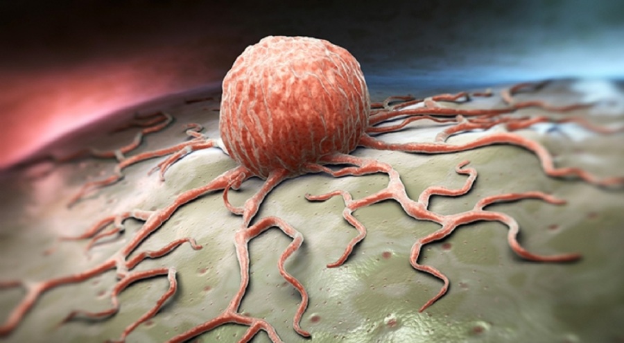 Araştırma: 'Sağlıklı' yiyecekler kansere neden oluyor