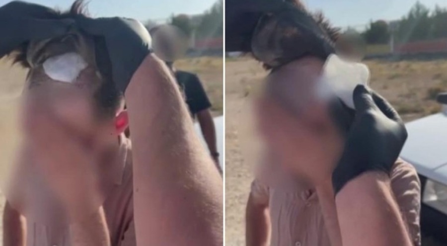 Protez saçtan uyuşturucu çıktı