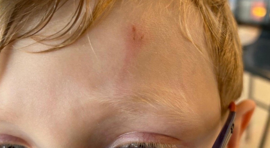 Öğretmen dehşeti! 7 yaşındaki öğrenci demir çubukla dövüldü