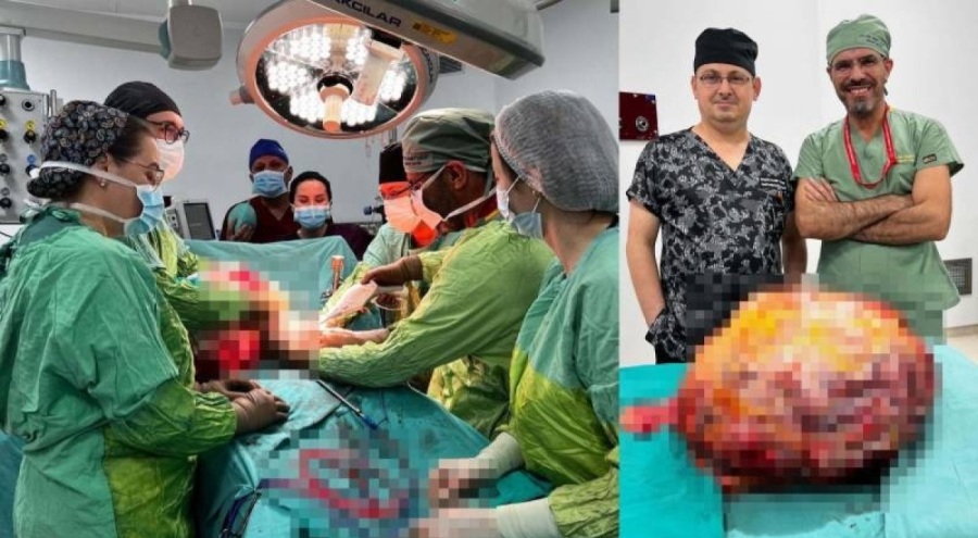 Karın ağrısı şikayetiyle gitti, karnından 26 kiloluk tümör çıkarıldı!