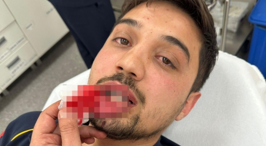 Bursa'da ambulans şoförü darp edildi!