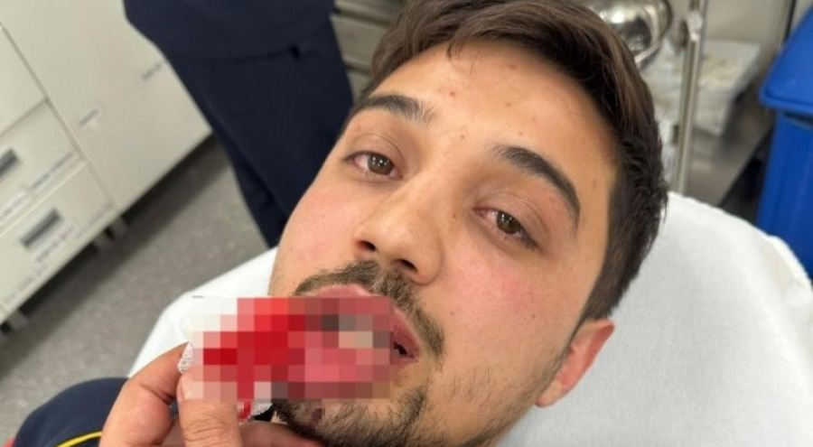 Bursa'da ambulans sürücüsüne darp anları ortaya çıktı!