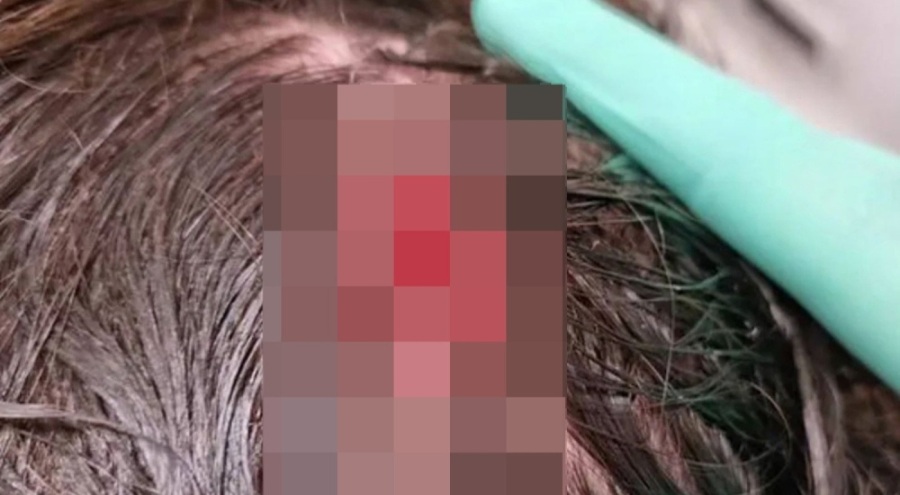 Zlatan Ibrahimovic'in kafası yarıldı!