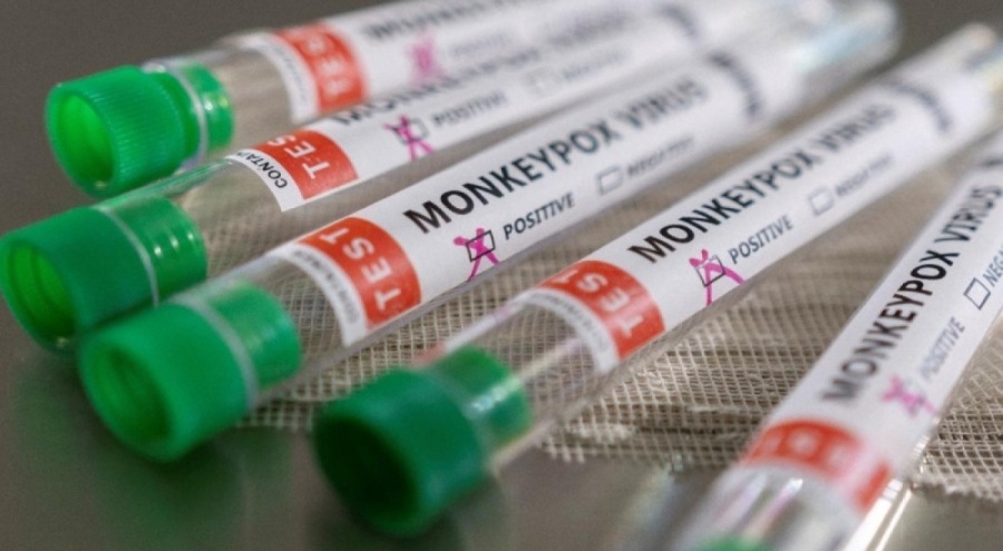 O ülkede M çiçeği virüsüne karşı 14 bin kişiye aşılama yapıldı