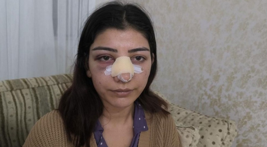 Konserde kabusu yaşadı: Yer tartışması sonrası yumruk yedi