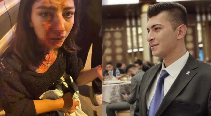 AK Parti'li Gençlik Kolları Başkanı Ünlüer, serbest bırakıldı: 'Nasıl vurdum' diye övündü, görevden alındı